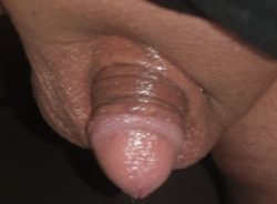 Tiny penis