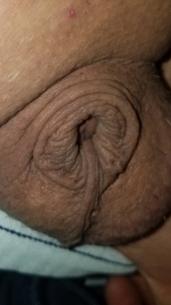 Inverted micro clit