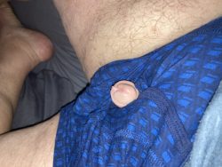 Poking out of my shorts.