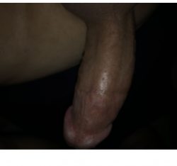 This swollen cock needs to cum… can anyone help