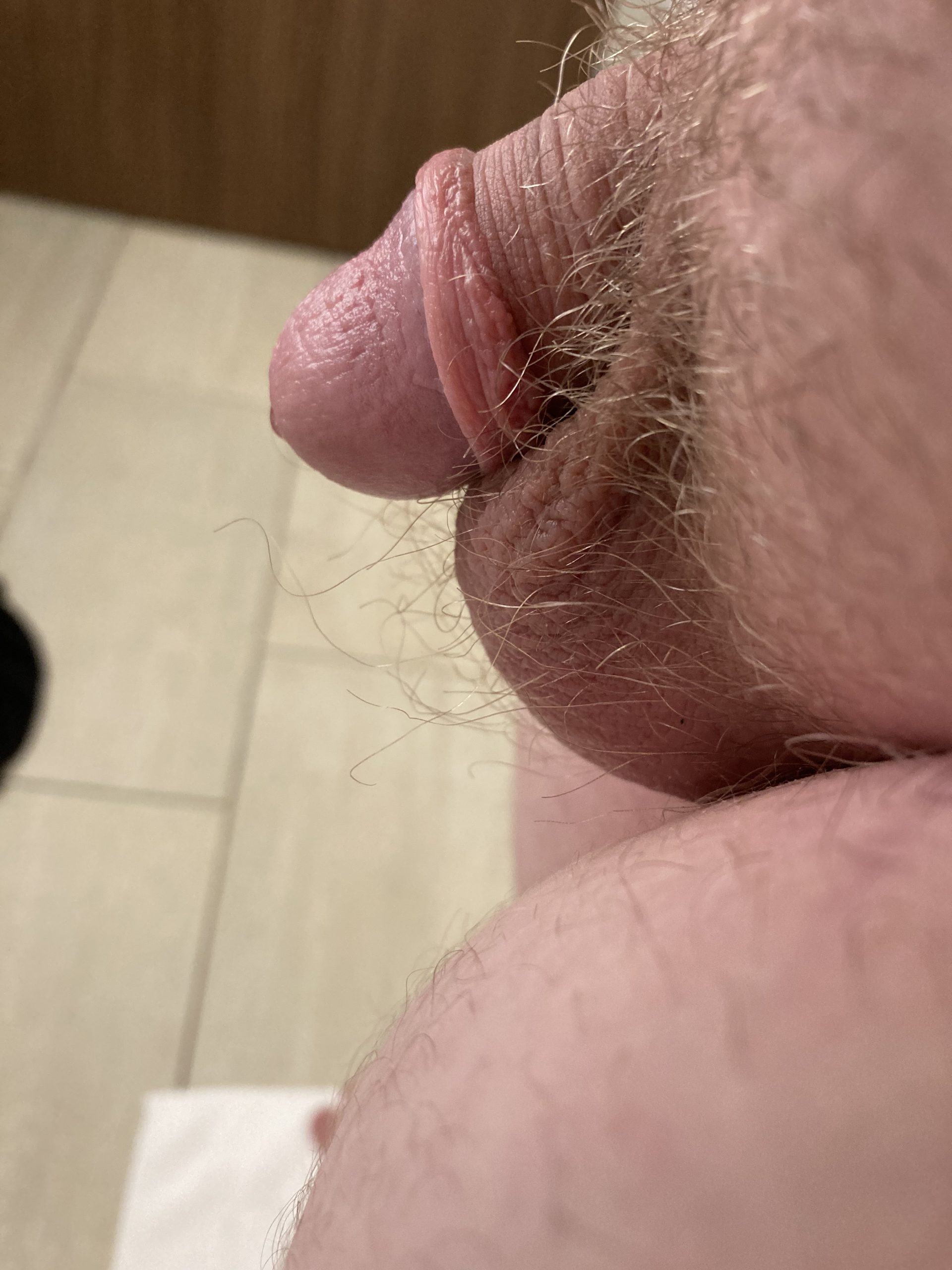 Micropenis Masturbation