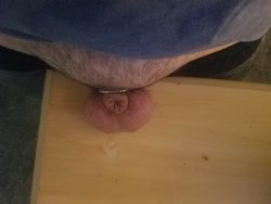 Instead of being worried about it i would love for more anal sex only no longer cum from my limp ...