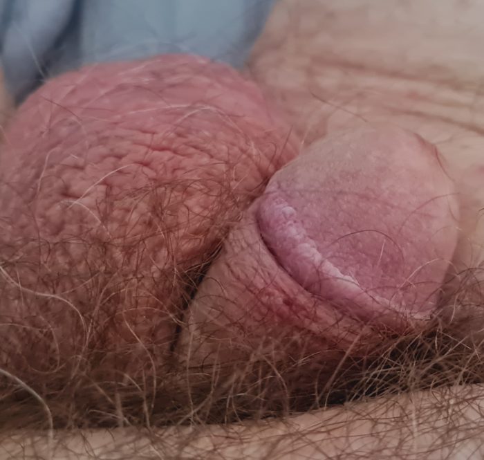 My smallie penis