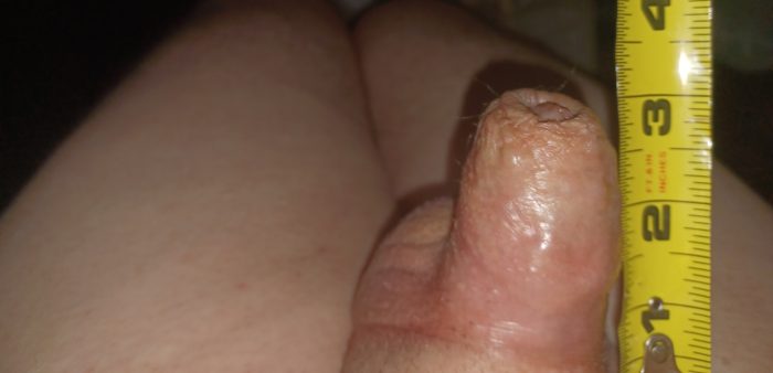 3 inch erect Micropenis loser!