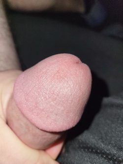 Circumcised head close up