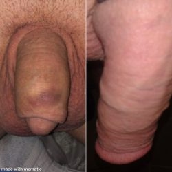 Limp clit vs limp cock