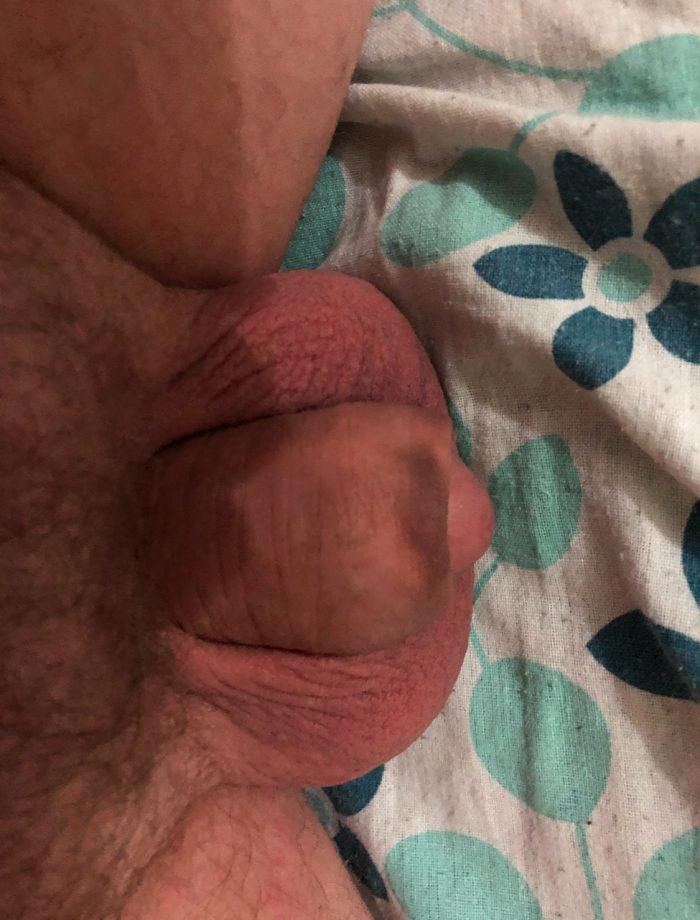 My clit