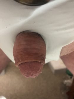 My micropenis