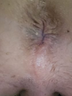 My blown out ass hole