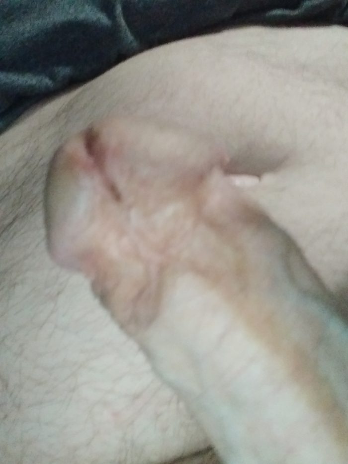 More my penis